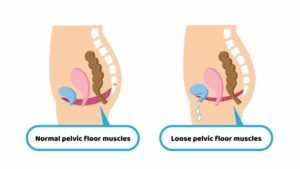 postnatal fitness exercises pelvic floor Rosie Stockley